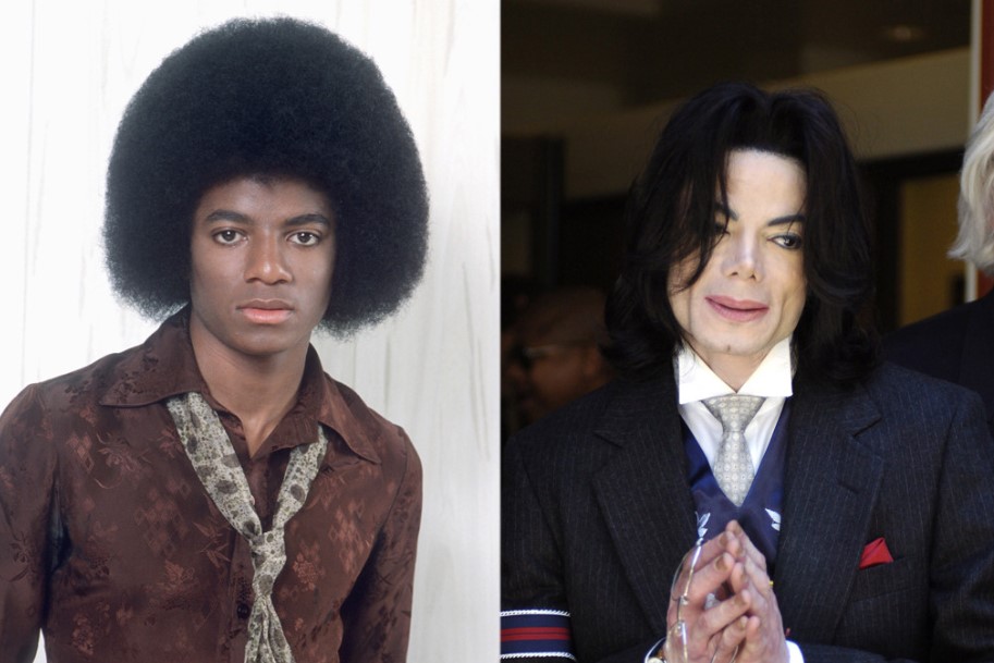 Michael Jackson Plastic Surger