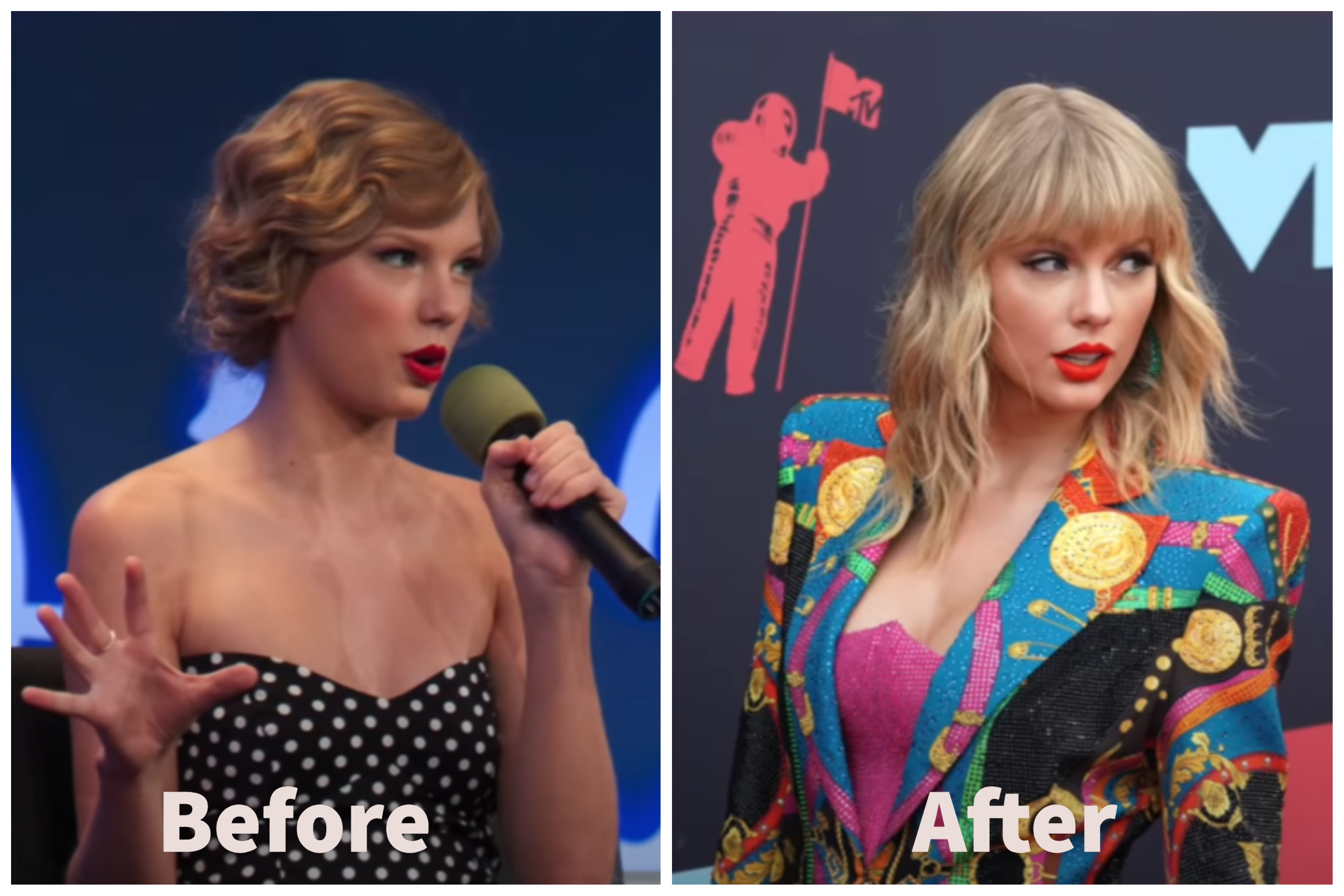 Taylor Swift Before and After Plastic Surgery