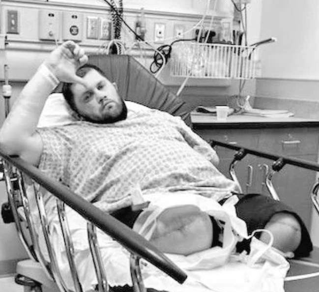 Jimmy Rave had both his legs and left arm amputated