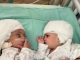 Conjoined Twins' Extraordinary Transformation into Independent Individuals