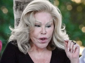 From Swiss Beauty to Plastic Surgery Disaster: Jocelyn Wildenstein